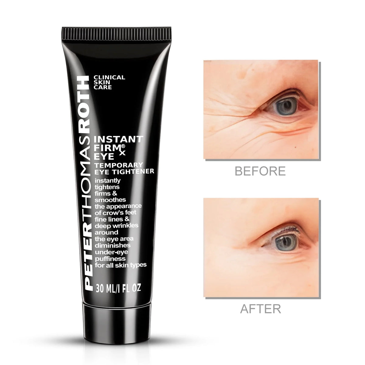 Instant FirmX Eye 1 oz I877420