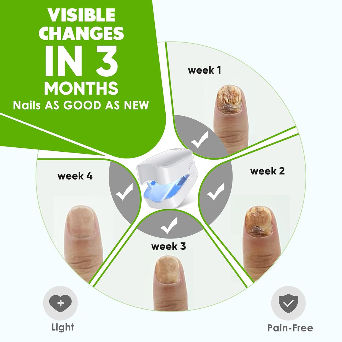 Blue Light for Nail Fungus K986899